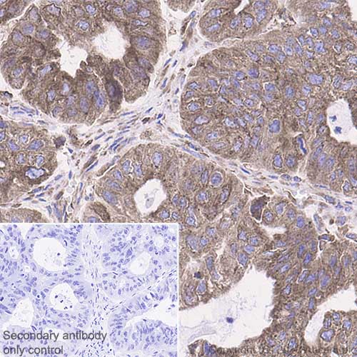 Immunohistochemistry (Formalin/PFA-fixed paraffin-embedded sections) - Anti-GRP78 BiP antibody [EPR4040(2)] (AB108613)