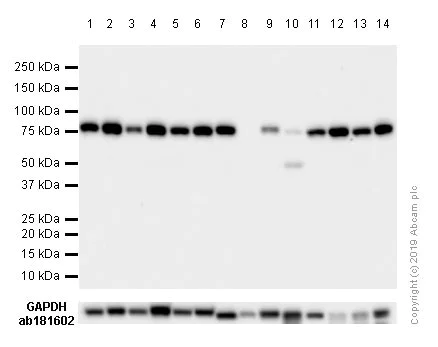Western blot - Anti-GRP78 BiP antibody [EPR4040(2)] (AB108613)
