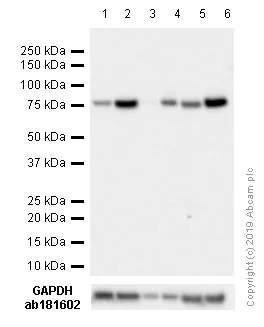 Western blot - Anti-GRP78 BiP antibody [EPR4040(2)] (AB108613)