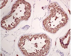 Immunohistochemistry (Formalin/PFA-fixed paraffin-embedded sections) - Anti-GRP78 BiP antibody [EPR4040(2)] - BSA and Azide free (AB226042)