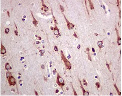 Immunohistochemistry (Formalin/PFA-fixed paraffin-embedded sections) - Anti-GRP78 BiP antibody [EPR4040(2)] - BSA and Azide free (AB226042)
