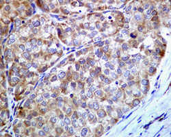 Immunohistochemistry (Formalin/PFA-fixed paraffin-embedded sections) - Anti-GRP78 BiP antibody [EPR4041(2)] (AB108615)