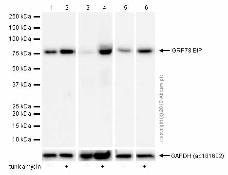 Anti-GRP78 BiP antibody [EPR4041(2)]
