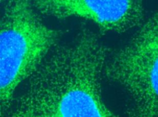 Immunocytochemistry/ Immunofluorescence - Anti-GRP94 antibody (AB18055)