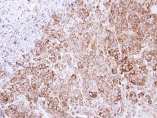 Immunohistochemistry (Formalin/PFA-fixed paraffin-embedded sections) - Anti-GRP94 antibody (AB227293)