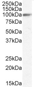 Western blot - Anti-GRP94 antibody (AB52031), expandable thumbnail