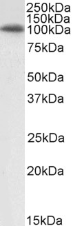 Western blot - Anti-GRP94 antibody (AB52031), expandable thumbnail