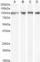 Western blot - Anti-GRP94 antibody (AB52031), expandable thumbnail