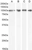 Western blot - Anti-GRP94 antibody (AB52031)