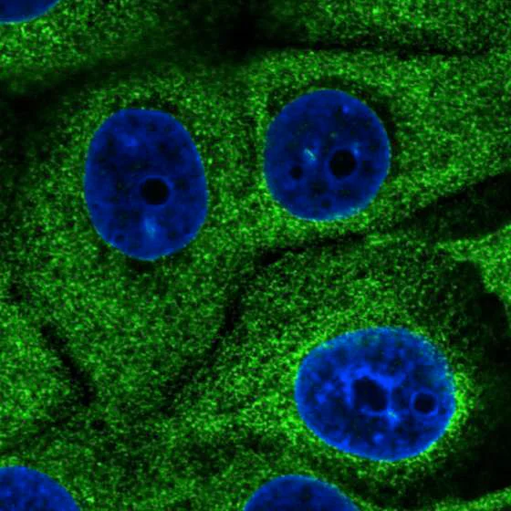 Immunocytochemistry/ Immunofluorescence - Anti-GRP94 antibody [CL2647] - C-terminal (AB210960)