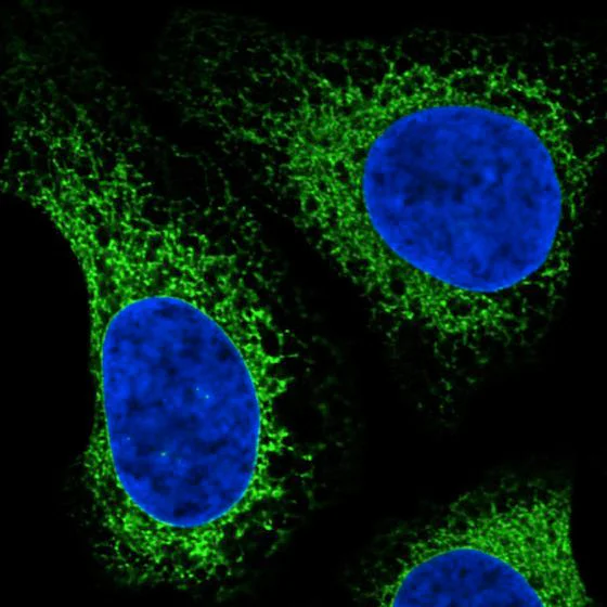 Immunocytochemistry/ Immunofluorescence - Anti-GRP94 antibody [CL2647] - C-terminal (AB210960)
