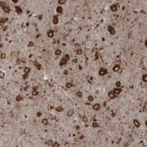Immunohistochemistry (Formalin/PFA-fixed paraffin-embedded sections) - Anti-GRP94 antibody [CL2647] - C-terminal (AB210960)
