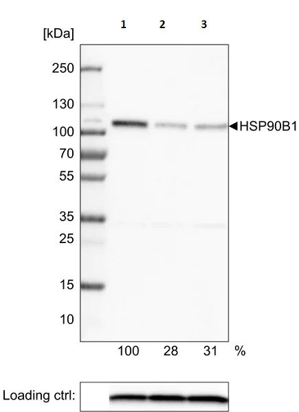 Western blot - Anti-GRP94 antibody [CL2647] - C-terminal (AB210960)