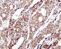 Immunohistochemistry (Formalin/PFA-fixed paraffin-embedded sections) - Anti-GRP94 antibody [EPR3988] (AB108606)