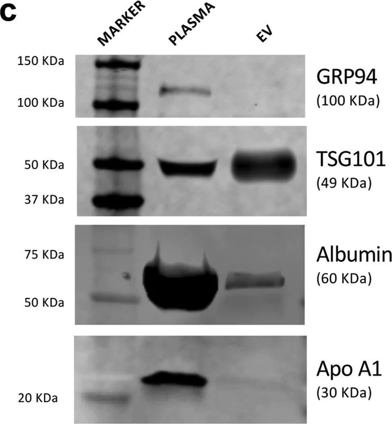 Western blot - Anti-GRP94 antibody [EPR3988] (AB108606)