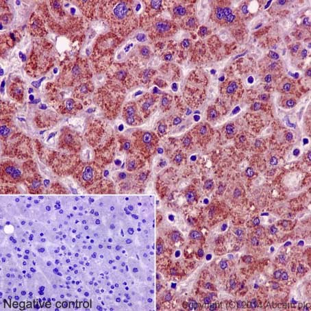 Immunohistochemistry (Formalin/PFA-fixed paraffin-embedded sections) - Anti-GRSF1 antibody [EPR16679] (AB194358), expandable thumbnail