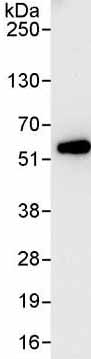 Immunoprecipitation - Anti-GRWD1 antibody (AB176815), expandable thumbnail