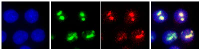 Immunocytochemistry/ Immunofluorescence - Anti-GRWD1 antibody (AB188419)