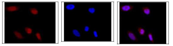 Immunocytochemistry/ Immunofluorescence - Anti-GRWD1 antibody (AB188419)