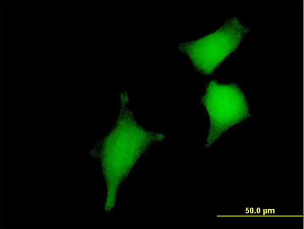 Immunocytochemistry/ Immunofluorescence - Anti-GRX2 antibody (AB167207)