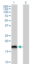 Western blot - Anti-GRX2 antibody (AB167207)