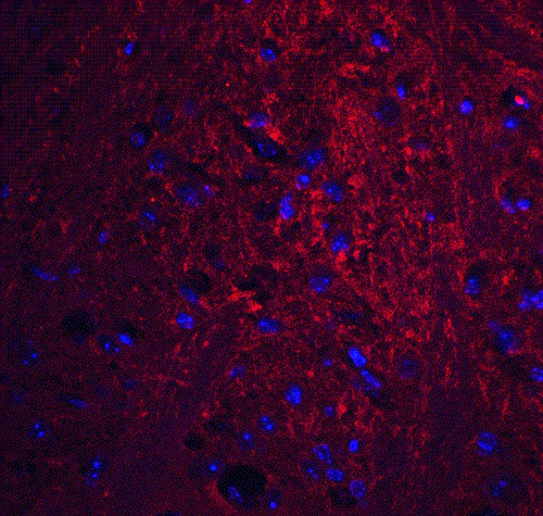 Immunohistochemistry (Formalin/PFA-fixed paraffin-embedded sections) - Anti-GSAP antibody (AB106630)