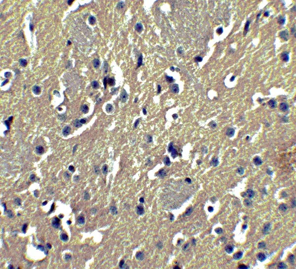 Immunohistochemistry (Formalin/PFA-fixed paraffin-embedded sections) - Anti-GSAP antibody (AB106630)