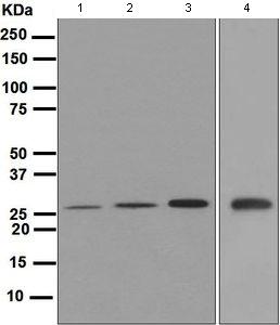 Western blot - Anti-GSC antibody [EPR4847] - BSA and Azide free (AB247751), expandable thumbnail