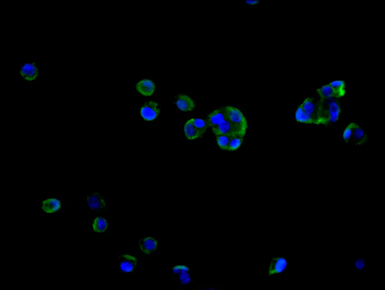 Immunocytochemistry/ Immunofluorescence - Anti-GSDMA antibody (AB237615)