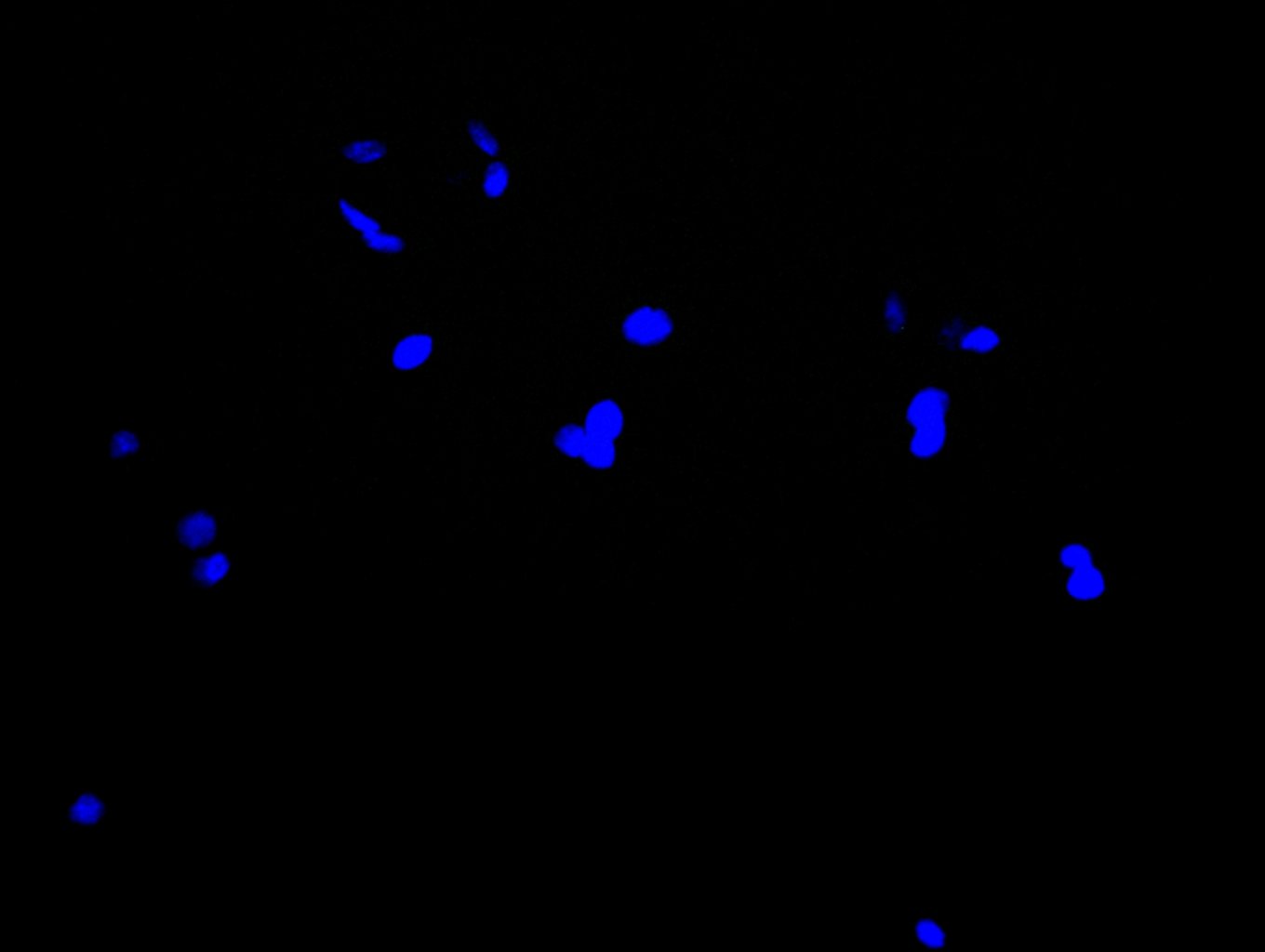 Immunocytochemistry/ Immunofluorescence - Anti-GSDMA antibody (AB237615)