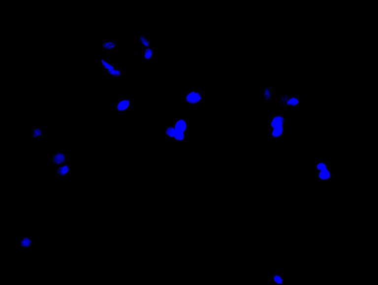 Immunocytochemistry/ Immunofluorescence - Anti-GSDMA antibody (AB237615)