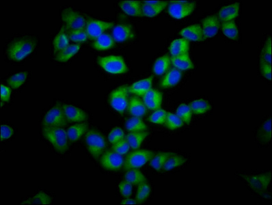Immunocytochemistry/ Immunofluorescence - Anti-GSDMA antibody (AB237615)