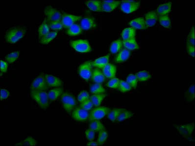 Immunocytochemistry/ Immunofluorescence - Anti-GSDMA antibody (AB237615)