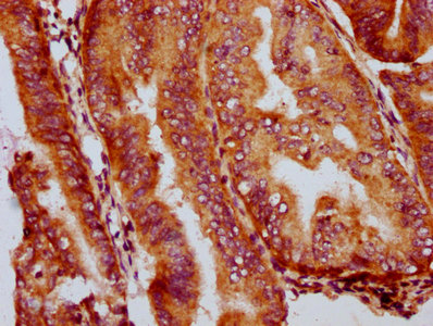 Immunohistochemistry (Formalin/PFA-fixed paraffin-embedded sections) - Anti-GSDMA antibody (AB237615)
