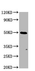 Western blot - Anti-GSDMA antibody (AB237615)