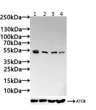 Western blot - Anti-GSDMA antibody (AB237615)