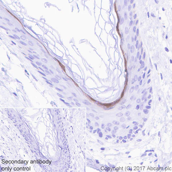 Immunohistochemistry (Formalin/PFA-fixed paraffin-embedded sections) - Anti-GSDMA antibody [EPR19858-104] (AB230768)