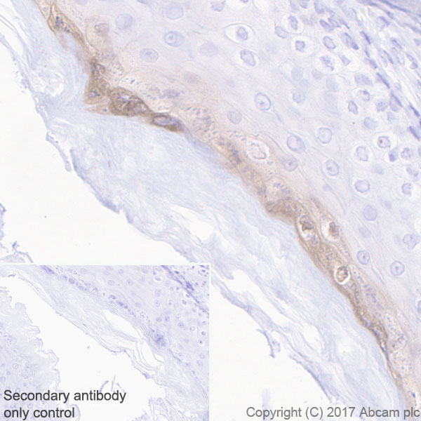 Anti-GSDMA antibody [EPR19858-104]