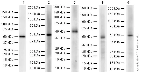 Western blot - Anti-GSDMA antibody [EPR19858-104] (AB230768)
