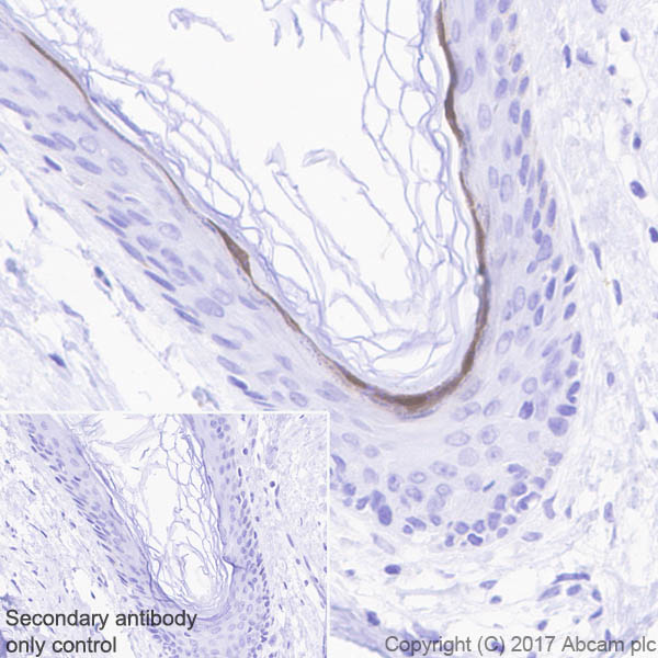 Immunohistochemistry (Formalin/PFA-fixed paraffin-embedded sections) - Anti-GSDMA antibody [EPR19858-104] - BSA and Azide free (AB231077)