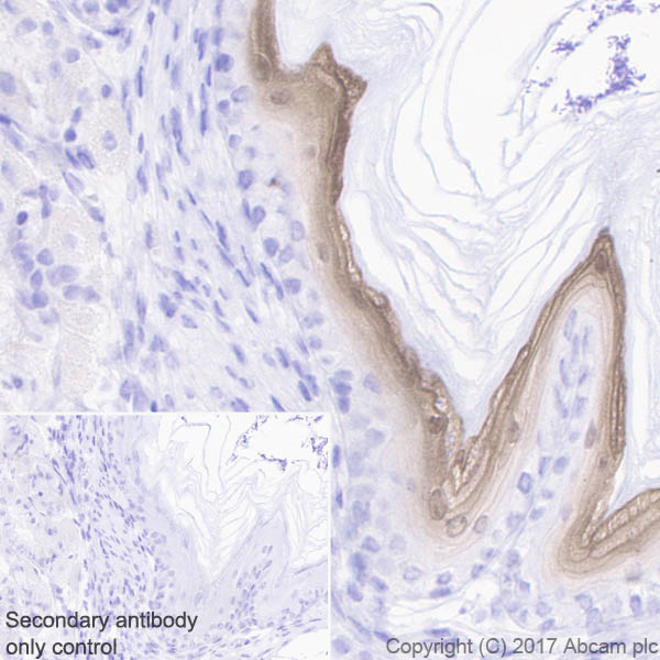 Immunohistochemistry (Formalin/PFA-fixed paraffin-embedded sections) - Anti-GSDMA antibody [EPR19858-104] - BSA and Azide free (AB231077)