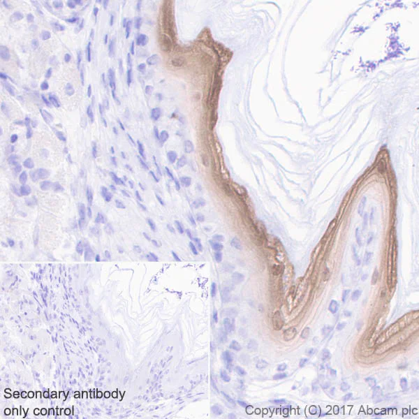 Immunohistochemistry (Formalin/PFA-fixed paraffin-embedded sections) - Anti-GSDMA antibody [EPR19858-104] - BSA and Azide free (AB231077)