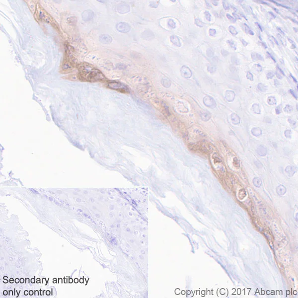 Immunohistochemistry (Formalin/PFA-fixed paraffin-embedded sections) - Anti-GSDMA antibody [EPR19858-104] - BSA and Azide free (AB231077)