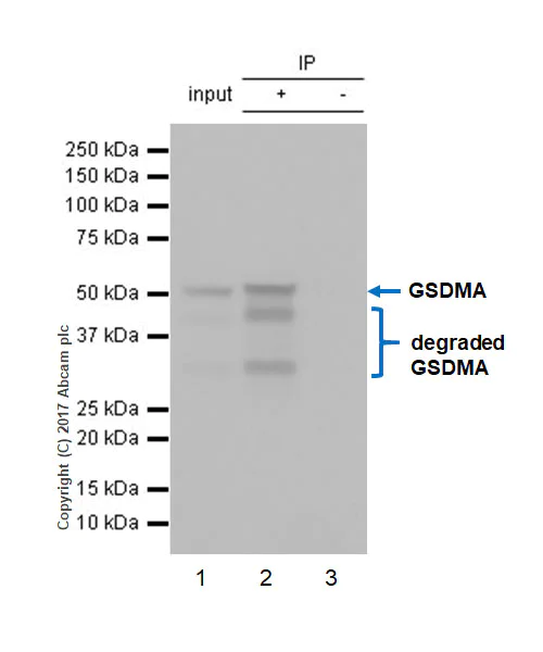 Immunoprecipitation - Anti-GSDMA antibody [EPR19858-104] - BSA and Azide free (AB231077)