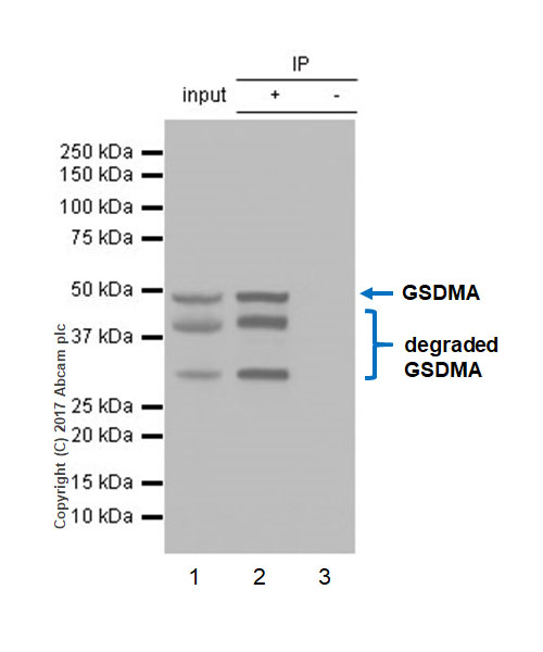 Immunoprecipitation - Anti-GSDMA antibody [EPR19858-116] - BSA and Azide free (AB245942)