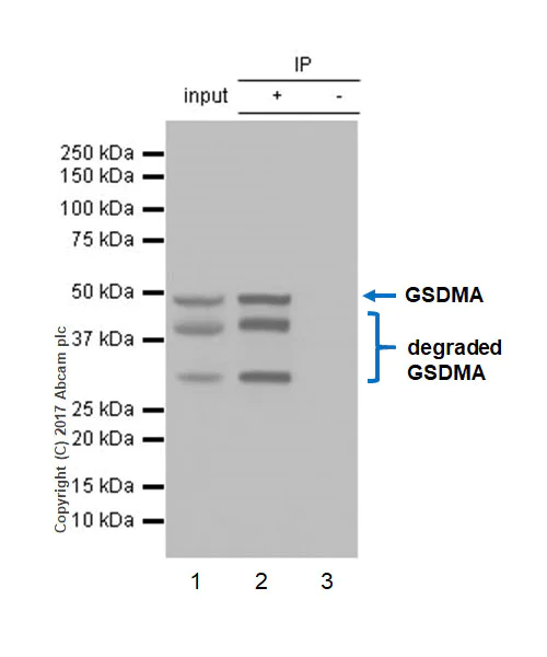 Immunoprecipitation - Anti-GSDMA antibody [EPR19858-116] - BSA and Azide free (AB245942)
