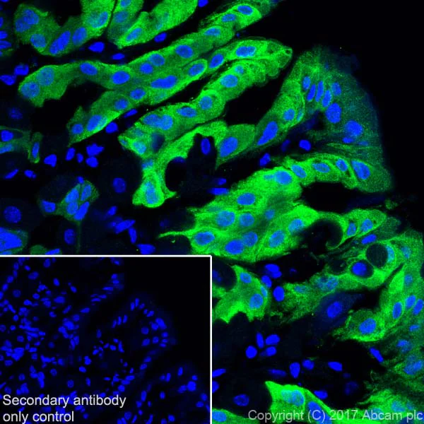 Immunohistochemistry (Frozen sections) - Anti-GSDMA antibody [EPR19858-17] (AB214818)