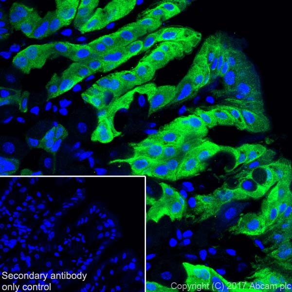 Immunohistochemistry (Frozen sections) - Anti-GSDMA antibody [EPR19858-17] - BSA and Azide free (AB231043)