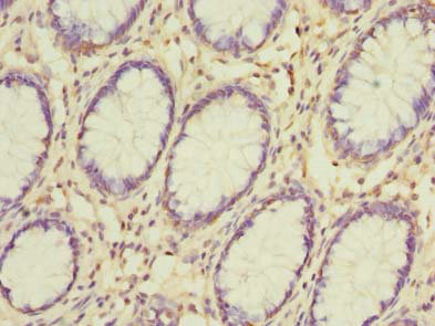 Immunohistochemistry (Formalin/PFA-fixed paraffin-embedded sections) - Anti-GSDMB antibody (AB235540)