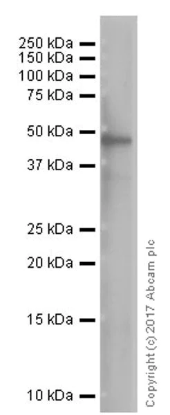 Western blot - Anti-GSDMB antibody [EPR20841] (AB215729)